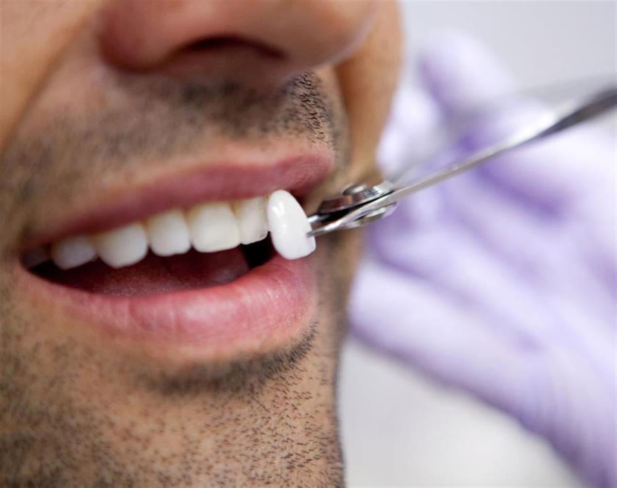 افضل عيادة اسنان في الشارقة